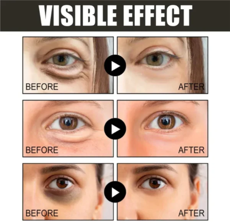 Kofeínový očný krém