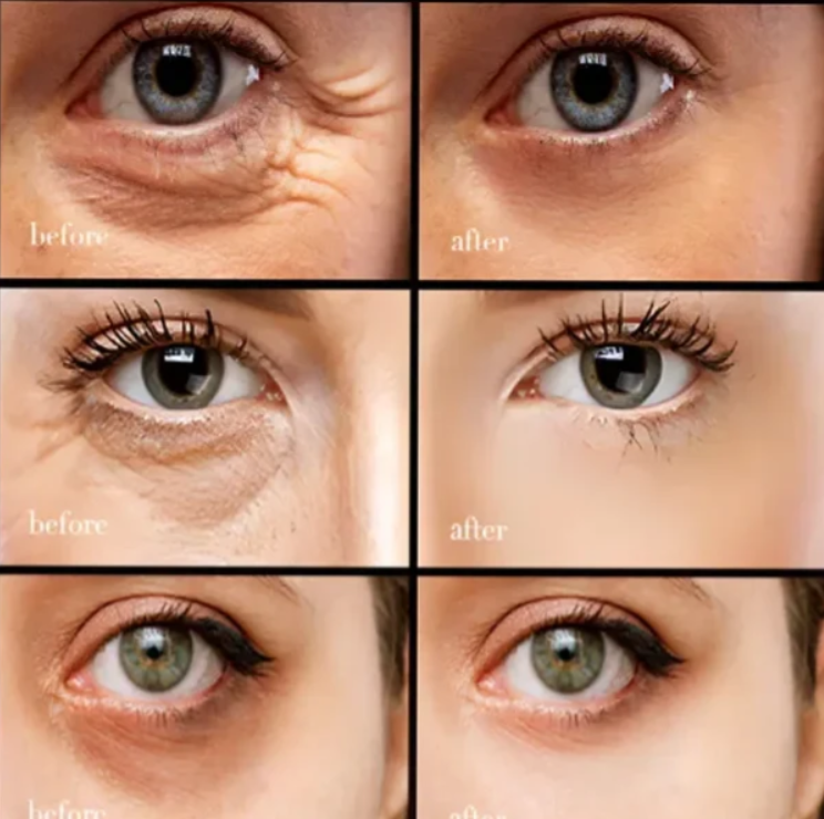 Kofeínový očný krém